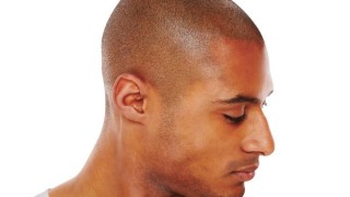 Hair Protection With Scalp Pigmentation