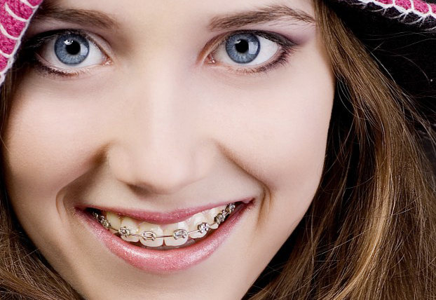 WHAT ARE THE SIGNS THAT YOUR CHILD NEEDS BRACES