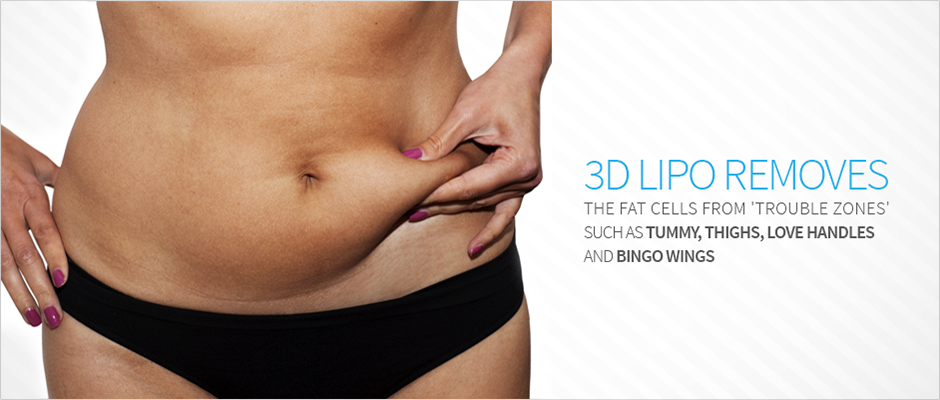 Rejuvenate Your Shape With 3d Liposuction Procedure
