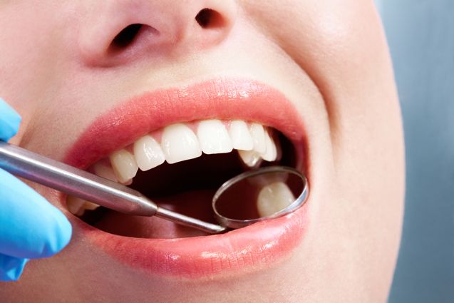 How To Prevent Cavities When You Have A Sweet Tooth