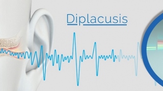 diplacusis